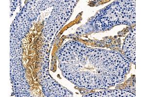 ABIN7094989 and ABIN7099045 at 1/100 staining mouse testis tissue by IHC-P. (RRBP1 Antikörper)