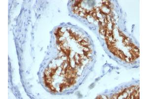 Immunohistochemistry (IHC) image for anti-Fascin (FSCN1) antibody (ABIN6940607)