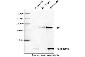 Western blot analysis of immunoprecipitates from mouse brain lysates. (PVALB Antikörper)
