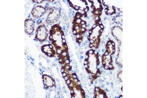 Immunohistochemistry of paraffin-embedded Mouse kidney using FCHSD1 Rabbit pAb (ABIN7270317) at dilution of 1:100 (40x lens). (FCHSD1 Antikörper  (AA 100-400))