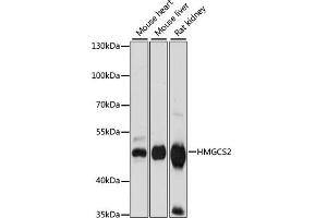 Western blot analysis of extracts of various cell lines, using HMGCS2 antibody (ABIN7265329) at 1:1000 dilution. (HMGCS2 Antikörper  (AA 269-508))