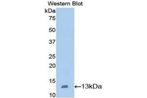 Western Blotting (WB) image for anti-Nephrosis 1, Congenital, Finnish Type (Nephrin) (NPHS1) (AA 39-144) antibody (ABIN7432919)