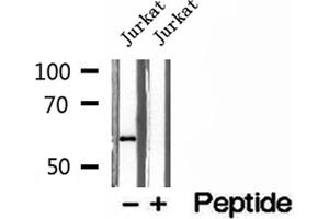 Western blot analysis of extracts of Jurkat cells, using PHGDH antibody. (PHGDH Antikörper  (N-Term))