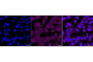 Immunocytochemical staining of HepG2 cells with RAD21 antibody (ABIN7800115), 1:1,000). (Rekombinanter RAD21 Antikörper)