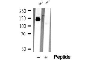 Western blot analysis of extracts of HeLa cells, using mDia1 antibody. (DIAPH1 Antikörper)