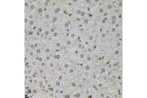 Immunohistochemistry of paraffin-embedded mouse liver using SKP2 antibody (ABIN1874793) at dilution of 1:100 (40x lens). (SKP2 Antikörper)
