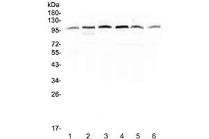 Western blot testing of human 1) placenta, 2) HepG2, 3) A549, 4) PANC-1, 5) SGC-7901 and 6) MDA-MB-231 lysate with MVP antibody at 0.