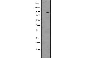 Western blot analysis of IL16 expression in A549 whole cell lysate ;,The lane on the left is treated with the antigen-specific peptide. (IL16 Antikörper  (C-Term))