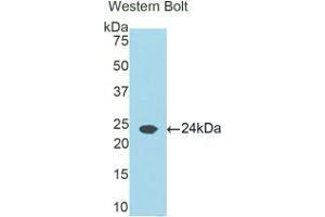Western blot analysis of the recombinant protein. (Retinol Binding Protein 5 Antikörper  (AA 19-201))