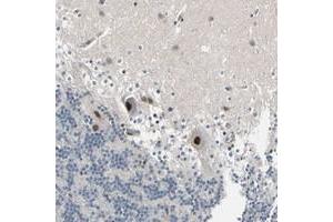 Immunohistochemical staining of human cerebellum with PSMA2 polyclonal antibody  shows strong nuclear positivity in purkinje cells. (PSMA2 Antikörper)