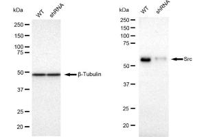 Western blotting analysis using Src antibody (ABIN7800055). (Rekombinanter Src Antikörper)