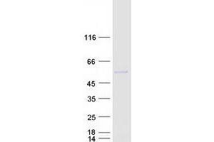 Validation with Western Blot (PLAU Protein (Transcript Variant 1) (Myc-DYKDDDDK Tag))