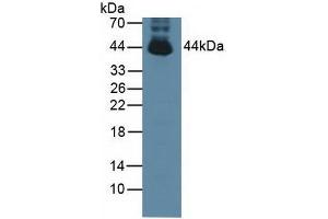 Detection of PTPN2 in Mouse Testis Tissue using Polyclonal Antibody to Protein Tyrosine Phosphatase, Non Receptor Type 2 (PTPN2) (PTPN2 Antikörper  (AA 1-257))