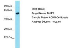 Image no. 1 for anti-BCL2/adenovirus E1B 19kDa Interacting Protein 2 (BNIP2) (AA 152-201) antibody (ABIN6750468) (BNIP2 Antikörper  (AA 152-201))