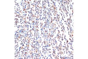 Immunohistochemistry of paraffin-embedded human tonsil using ZMYM3 antibody (ABIN6128940, ABIN6150453, ABIN6150454 and ABIN6216809) at dilution of 1:100 (40x lens). (ZMYM3 Antikörper  (AA 140-300))