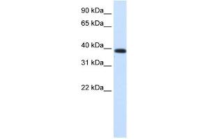 WB Suggested Anti-PTDSR Antibody Titration: 0. (JMJD6 Antikörper  (Middle Region))