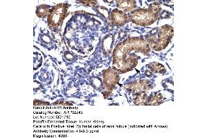 Human kidney (Aryl Hydrocarbon Receptor Antikörper  (N-Term))