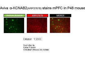 Immunohistochemistry (IHC) image for anti-Potassium Voltage-Gated Channel, Shaker-Related Subfamily, beta Member 2 (KCNAB2) (Middle Region) antibody (ABIN2780205)