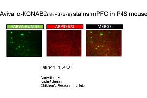 Sample Type: P48 MouseDilution: 1:2000 (KCNAB2 Antikörper  (Middle Region))