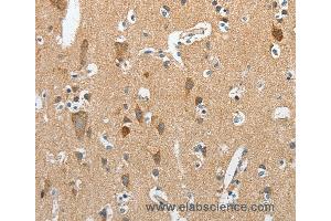 Immunohistochemistry of Human brain  using RCAN1 Polyclonal Antibody at dilution of 1:45