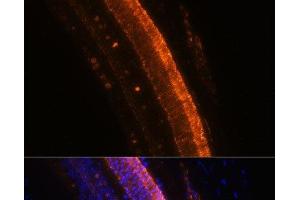 Immunofluorescence (IF) image for anti-Potassium Voltage-Gated Channel, Delayed-Rectifier, Subfamily S, Member 2 (KCNS2) antibody (ABIN7258586)
