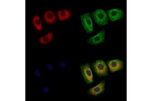 ABIN6256515 and ABIN6267566 staining Hela cells(4h of LPS treatment) by IF/ICC. (14-3-3 zeta Antikörper  (pThr232))