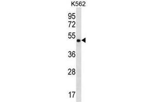 CCDC71 Antibody (C-term) western blot analysis in K562 cell line lysates (35µg/lane). (CCDC71 Antikörper  (C-Term))