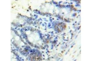 Used in DAB staining on fromalin fixed paraffin-embedded Bowels tissue (HMGA1 Antikörper  (AA 1-107))