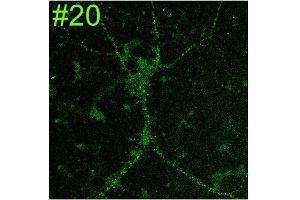 Cultured rat hippocampal neuron immunofluorescence.