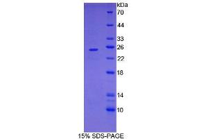 SDS-PAGE analysis of Mouse FOLR4 Protein. (Folate Receptor 4 Protein)