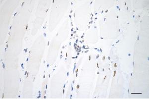 Immunohistochemistry was performed on paraffin-embedded mouse skeletal muscle using AKAP8 antibody (ABIN7797435), 1:200).