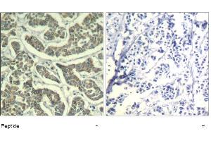 Image no. 1 for anti-Ataxia Telangiectasia and Rad3 Related (ATR) (Ser428) antibody (ABIN319379)