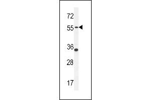 PDE12 Antibody (C-term) (ABIN654246 and ABIN2844072) western blot analysis in MDA-M cell line lysates (35 μg/lane). (PDE12 Antikörper  (C-Term))