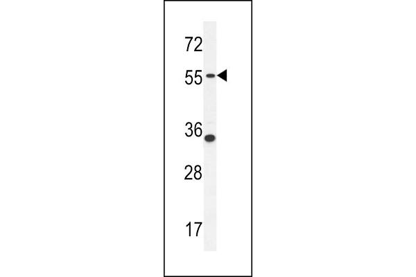 PDE12 Antikörper  (C-Term)