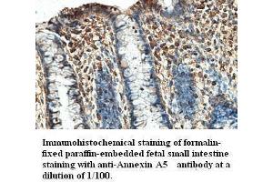 Image no. 1 for anti-Annexin A5 (ANXA5) antibody (ABIN791195) (Annexin V Antikörper)