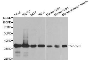 Western blot analysis of extracts of various cell lines, using GAPDH antibody. (GAPDH Antikörper  (AA 1-335))