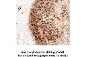Image no. 1 for anti-Neurofibromin 1 (NF1) (N-Term) antibody (ABIN363207) (Neurofibromin 1 Antikörper  (N-Term))