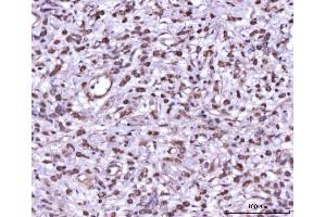 IHC analysis of MEK7/MAP2K7 using anti-MEK7/MAP2K7 antibody (ABIN3043875). (MAP2K7 Antikörper  (N-Term))