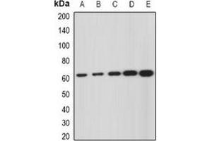 Western blot analysis of GNS expression in SKOV3 (A), Hela (B), mouse liver (C), mouse kidney (D), rat brain (E) whole cell lysates. (GNS Antikörper)