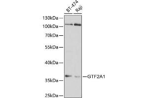 Western blot analysis of extracts of various cell lines, using GTF2 antibody (ABIN6128820, ABIN6141488, ABIN6141489 and ABIN6220980) at 1:1000 dilution. (GTF2A1 Antikörper  (AA 1-270))