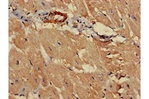 Immunohistochemistry of paraffin-embedded human heart tissue using ABIN7164812 at dilution of 1:100 (PCCA Antikörper  (AA 585-720))