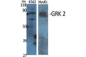 Western Blot (WB) analysis of specific cells using GRK 2 Polyclonal Antibody. (GRK2 Antikörper  (Ser129))