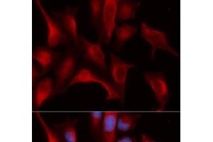 Immunofluorescence analysis of U2OS cells using PSMB4 Polyclonal Antibody (PSMB4 Antikörper)