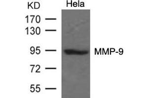 Western Blotting (WB) image for anti-Matrix Metallopeptidase 9 (Gelatinase B, 92kDa Gelatinase, 92kDa Type IV Collagenase) (MMP9) (AA 110-114) antibody (ABIN7138033)