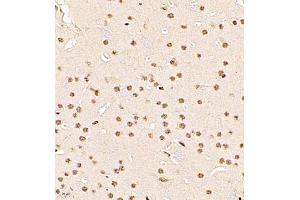 Immunohistochemistry of paraffin embedded mouse brain using RBAK (ABIN7075383) at dilution of 1:1000 (400x lens)