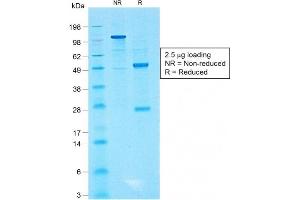 SDS-PAGE Analysis of Purified CD99 Rabbit Recombinant Monoclonal Antibody (MIC2/1495R). (Rekombinanter CD99 Antikörper)