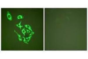 Immunofluorescence analysis of HepG2 cells, using HSP60 antibody. (HSPD1 Antikörper)