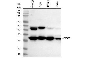 Western blot analysis of CTSD using anti-CTSD antibody (ABIN3044509). (Cathepsin D Antikörper  (AA 201-412))