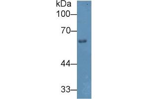 Western Blotting (WB) image for Heparanase (HPSE) ELISA Kit (ABIN6730979)