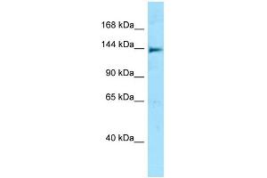 Western Blotting (WB) image for anti-NLR Family, CARD Domain Containing 5 (NLRC5) (N-Term) antibody (ABIN2788463) (NLRC5 Antikörper  (N-Term))